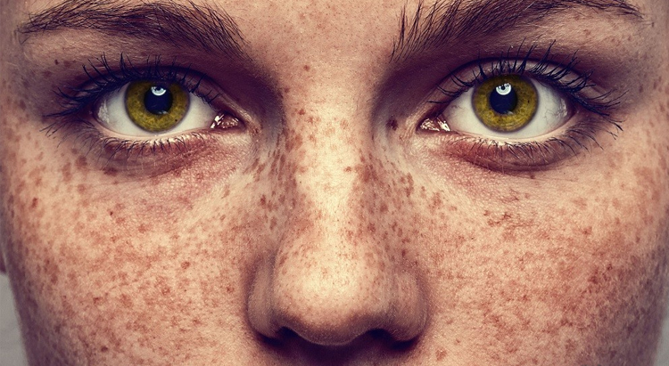 9 фактов о коже, о которых вы не знали
