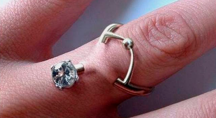 Любить до смерти: обручальные кольца вживляют прямо в пальцы